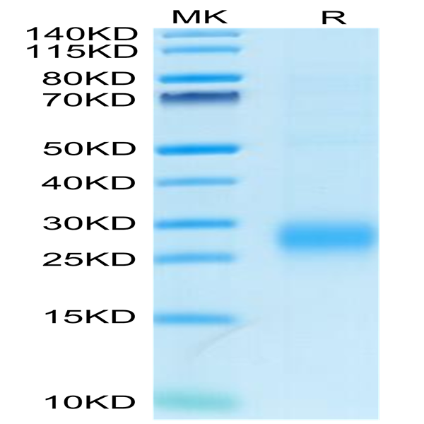 Human ALK-1/ACVRL1 Protein (ALK-HM101)