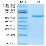 Human AMCase/CHIA Protein (AMC-HM101)