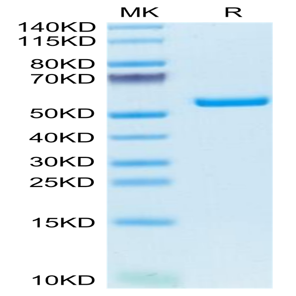 Mouse AMCase/CHIA Protein (AMC-MM101)