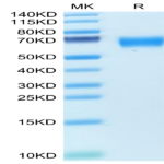Human AMIGO2 Protein (AMI-HM102)