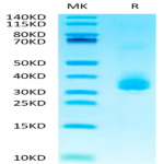 Biotinylated Human ANGPTL3/Angiopoietin-like 3 Protein (ANG-HM403B)