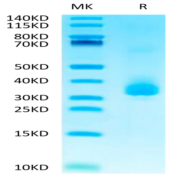 Biotinylated Human ANGPTL3/Angiopoietin-like 3 Protein (ANG-HM403B)
