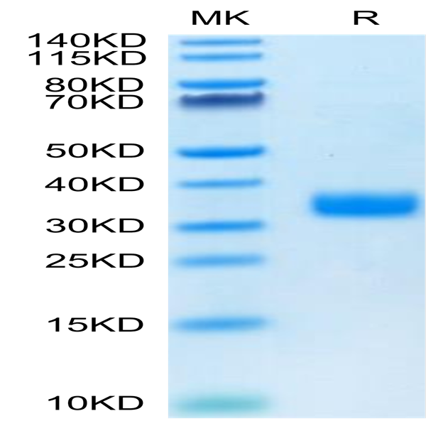 Mouse ANGPTL4/Angiopoietin-like 4 Protein (ANG-MM104)