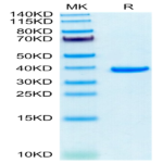 Human ANXA2 Protein BP004581 Syd Labs
