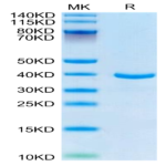 Human ANXA1 Protein BP004653 Syd Labs
