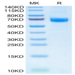 Human Alkaline phosphatase (Intestinal type) /ALPI Protein (APE-HM101)
