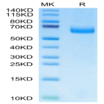Mouse Alkaline phosphatase (Intestinal type) /ALPI Protein BP003858 Syd Labs