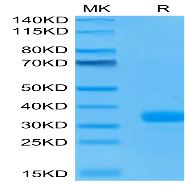 Human ANGPT2/Angiopoietin-2 Protein (APN-HM401)