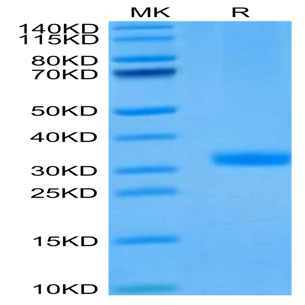 Mouse ANGPT2/Angiopoietin-2 Protein (APN-MM101)