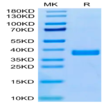 Human APOE3/Apolipoprotein E Protein (APO-HM101)