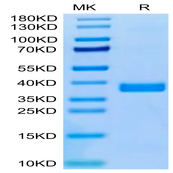 Human APOE3/Apolipoprotein E Protein (APO-HM101)