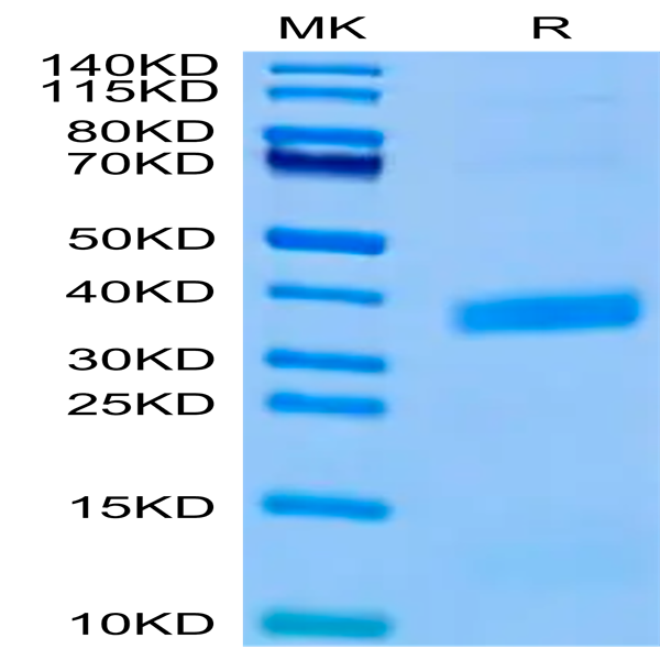 Biotinylated Human APOE3/Apolipoprotein E Protein (Primary Amine Labeling) (APO-HM101B)