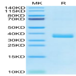Human APOE4/Apolipoprotein E Protein BP003620 Syd Labs