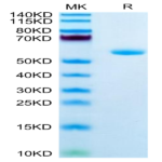 Human APOA1 Protein (APO-HM201)