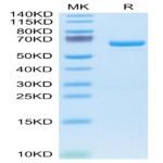 Human APOE4/Apolipoprotein E Protein BP004523 Syd Labs