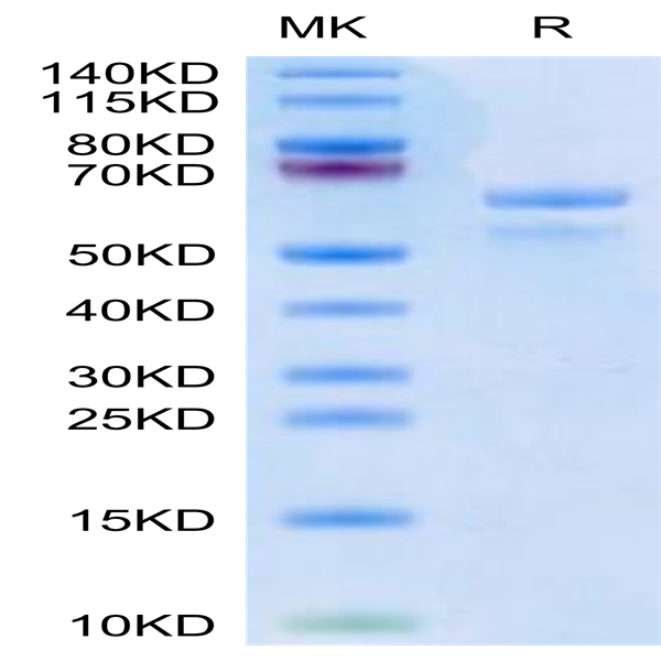 Human APOE3/Apolipoprotein E Protein (APO-HM203)