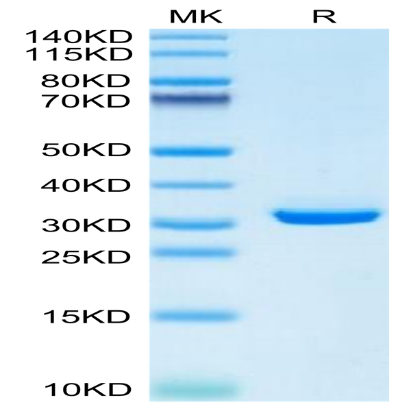 Mouse APOE/Apolipoprotein E Protein (APO-MM102)