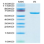 Mouse APOE/Apolipoprotein E Protein (APO-MM202)