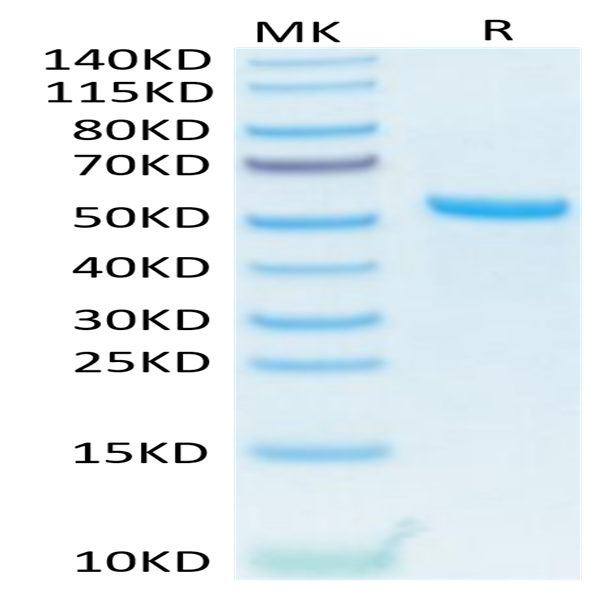 Human APRIL/TNFSF13 Trimer Protein (APR-HM110)