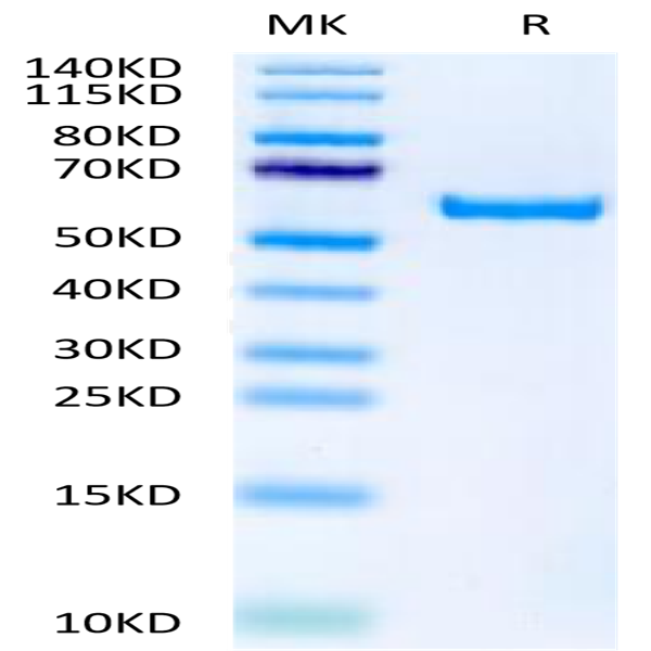 Biotinylated Human APRIL/TNFSF13 Trimer Protein (Primary Amine Labeling) (APR-HM110B)