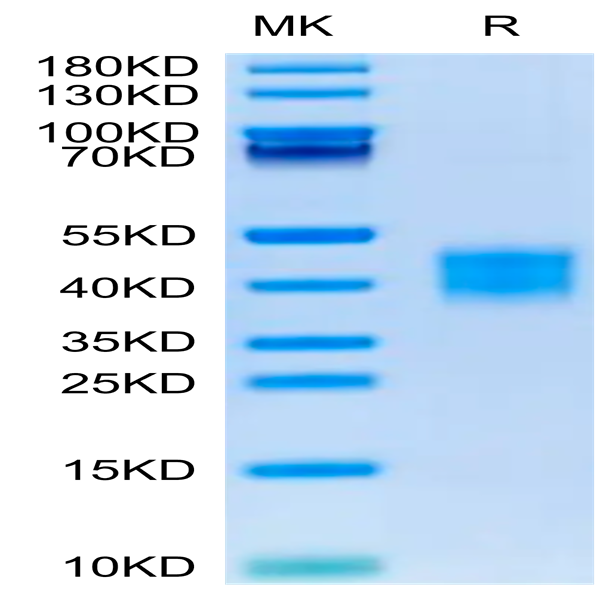 Mouse ASGR1 Protein (ASG-MM1R1)