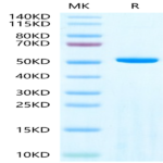 Human Adenylosuccinate Lyase Protein BP003351 Syd Labs
