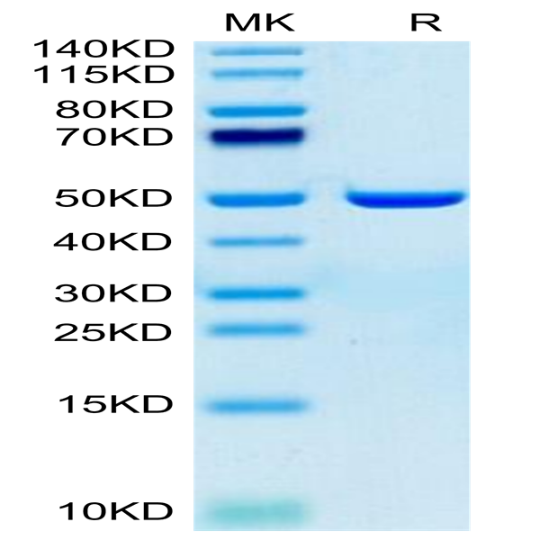 Human ASPH Protein (ASP-HE101)