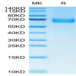 Human AXL Protein (AXL-HM101)