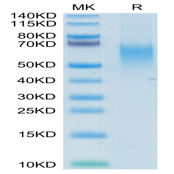 Human B7-1/CD80 Protein (B71-HM480)