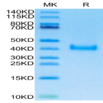 SARS-Cov-2 Spike RBD (Omicron BA.2.12.1) Protein (BA2-VM121)
