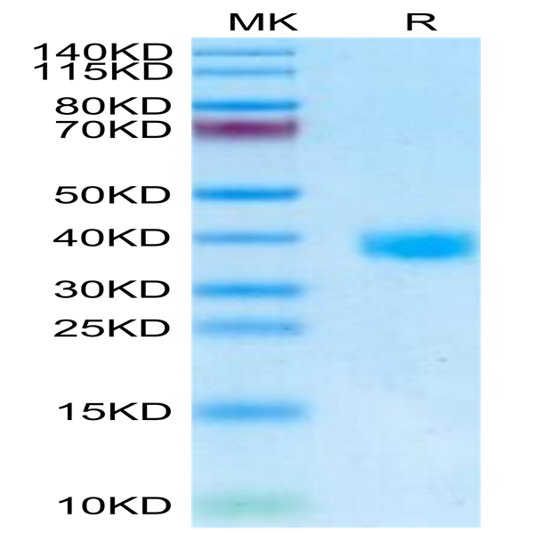 SARS-Cov-2 Spike RBD (Omicron BA.2/BA.2.2.1) Protein (BA2-VM1BD)