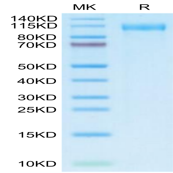 SARS-CoV-2 Spike S1 (Omicron BA.2.12.1) Protein (BA2-VM1S1)