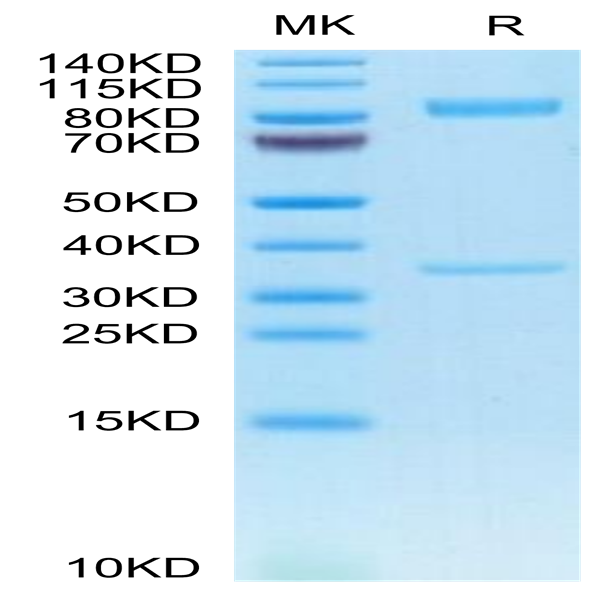 Human BACE-1 Protein (BAE-HM201)