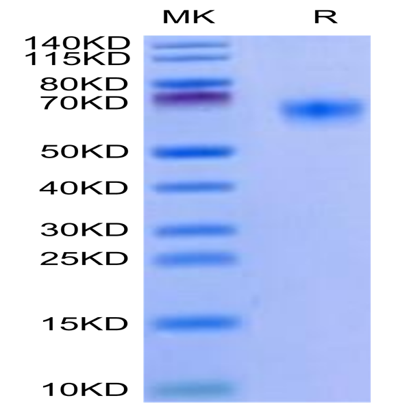 Mouse BACE-1 Protein (BAE-MM101)
