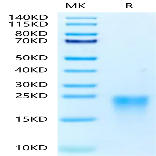 Human BAFFR/TNFRSF13C Protein (BAF-HM10R)