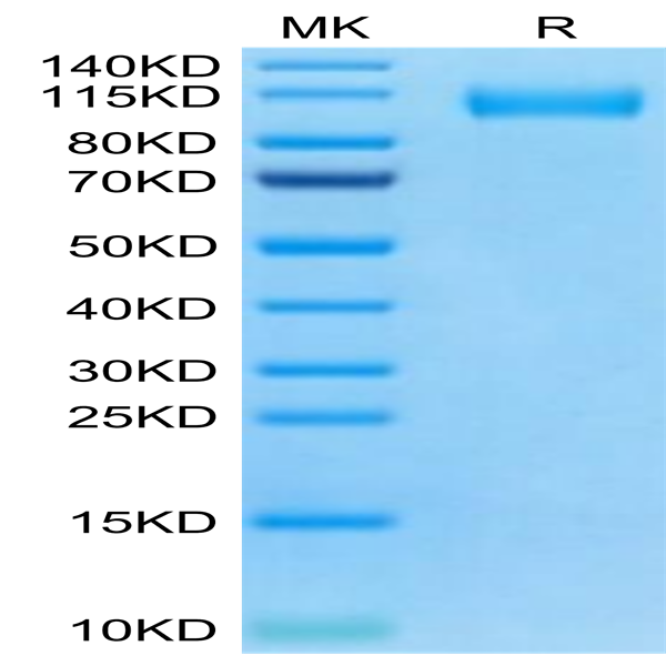 SARS-CoV-2 Spike S1 (Omicron BA.4/BA.5/BA.5.2) Protein (BAS-VM145)