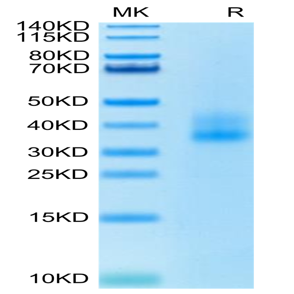 Human 4-1BB/TNFRSF9 Protein (BB4-HM141)