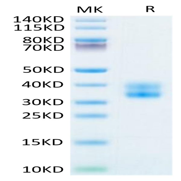 Biotinylated Human 4-1BB/TNFRSF9 Protein (BB4-HM441B)