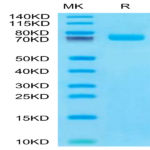 Human BCAM Protein (BCA-HM10M)