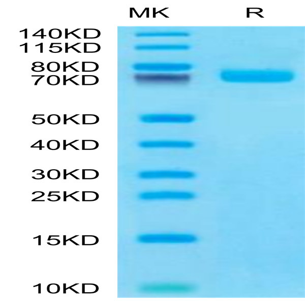Human BCAM Protein (BCA-HM10M)