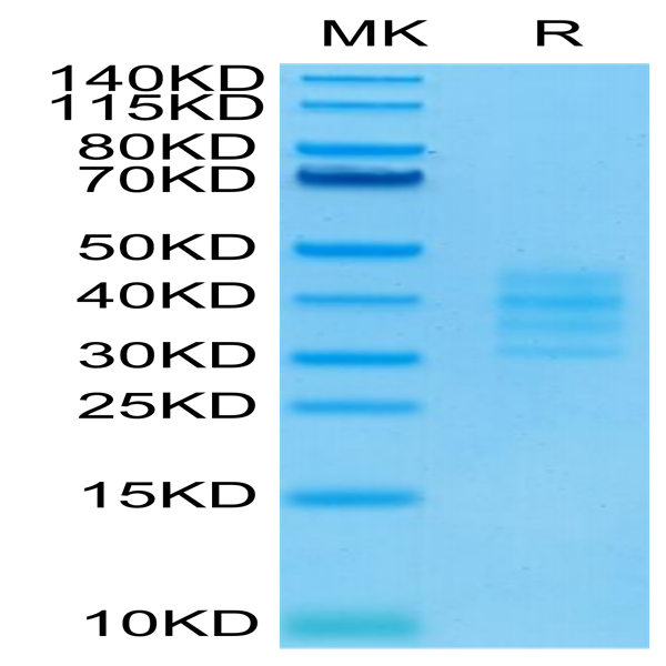 Biotinylated Human BCMA/TNFRSF17 Trimer Protein (BCM-HM417B)