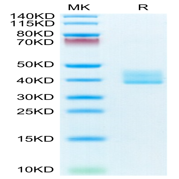 Mouse BCMA/TNFRSF17 Protein (BCM-MM217)