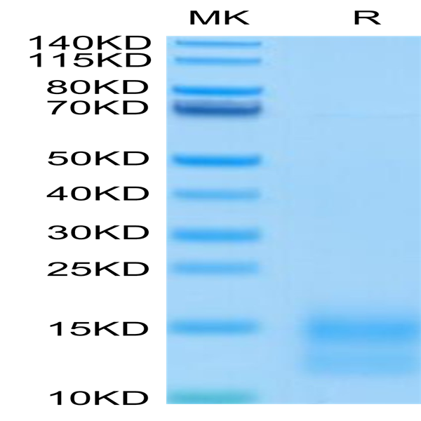 Mouse BCMA/TNFRSF17 Protein (BCM-MM417)