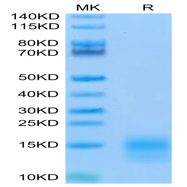 Biotinylated Mouse BCMA/TNFRSF17 Protein (BCM-MM417B)