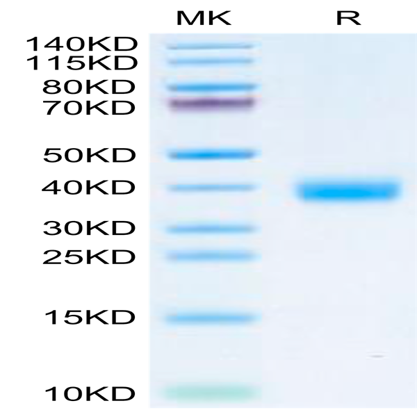 SARS-CoV-2 Spike RBD (Omicron BF.7/BA.4.6) Protein (BF7-HM146)