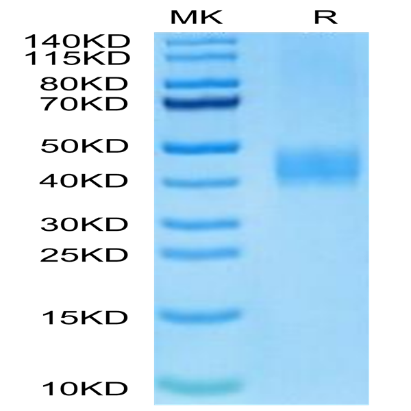 Biotinylated Human B7-H3 Protein (BH7-HM473B)