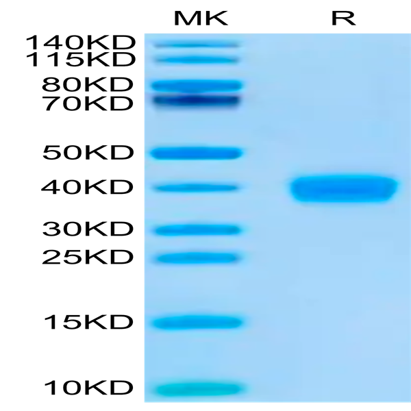 SARS-CoV-2 Spike RBD (Omicron BQ.1.1) Protein (BQ1-HM111)