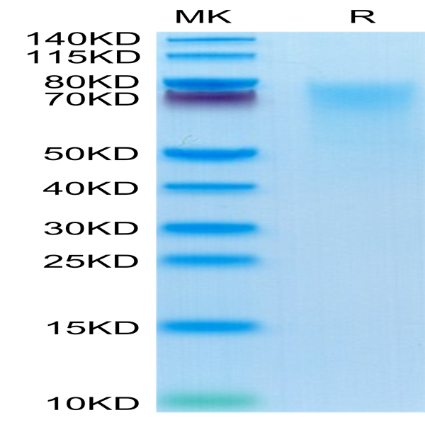 Human BSPII Protein (BSP-HM101)