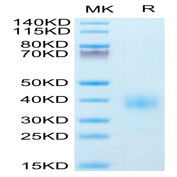 Human BTLA Protein (BTL-HM401)