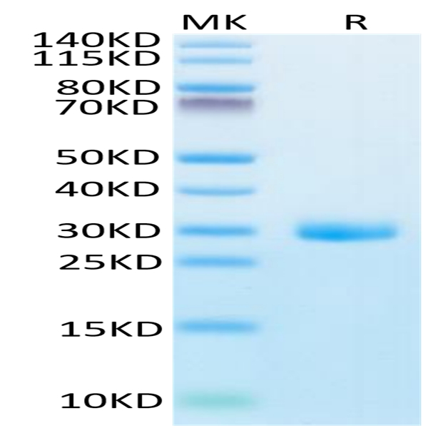 Human BTN3A1/CD277 Protein (BTN-HM1A1)